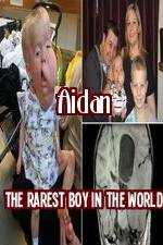 Watch Aidan The Rarest Boy In The World 123movies