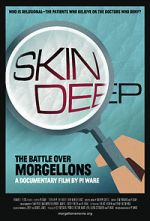 Watch Skin Deep: The Battle Over Morgellons 123movies