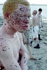 Watch Albino United 123movies