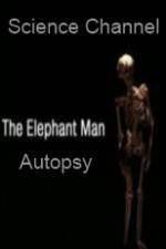 Watch Science Channel Elephant Man Autopsy 123movies