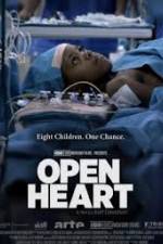 Watch Open Heart 123movies