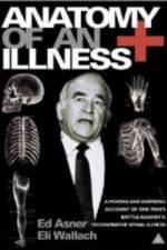 Watch Anatomy of an Illness 123movies