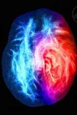 Watch Brain on Fire 123movies