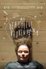 Watch My Beautiful Broken Brain 123movies