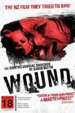 Watch Wound 123movies
