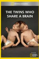 Watch National Geographic The Twins Who Share A Brain 123movies