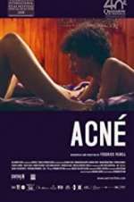 Watch Acné 123movies