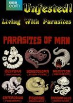 Watch Infested! Living with Parasites 123movies