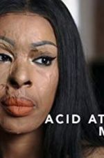 Watch Acid Attack: My Story 123movies