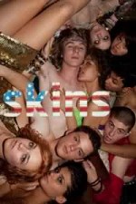 Watch Skins (US) 123movies